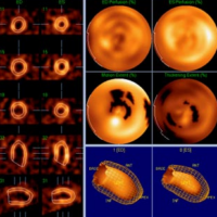 Cardiología