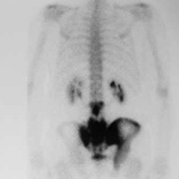 Patología osteoarticular
