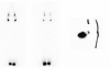 CAT angio05
