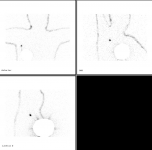 CAT cirurgia02