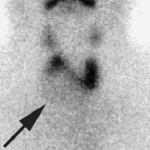 CAT endocrino04