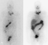 CAT endocrino05