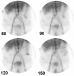 CAT gastro05