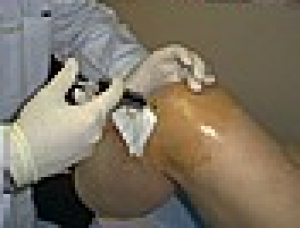 CAT terapia01