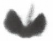 CAT terapia02