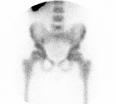 CAT trauma01