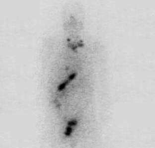 ASOnco1